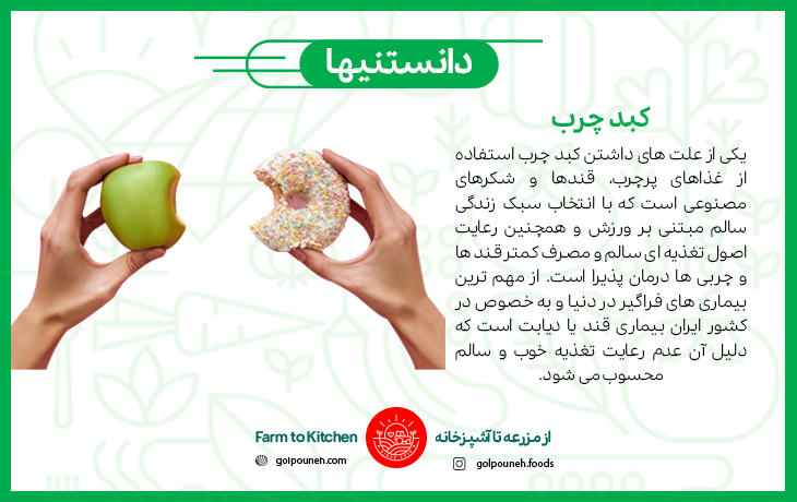 کبد چرب